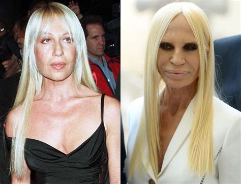 donatella versace oggi foto|donatella versace before and after.